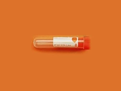 LP Italiana L116317 KF+Na2 EDTA, 5 ml, 16x60 mm  Ambalaj Miktarı: 1350 Ad.